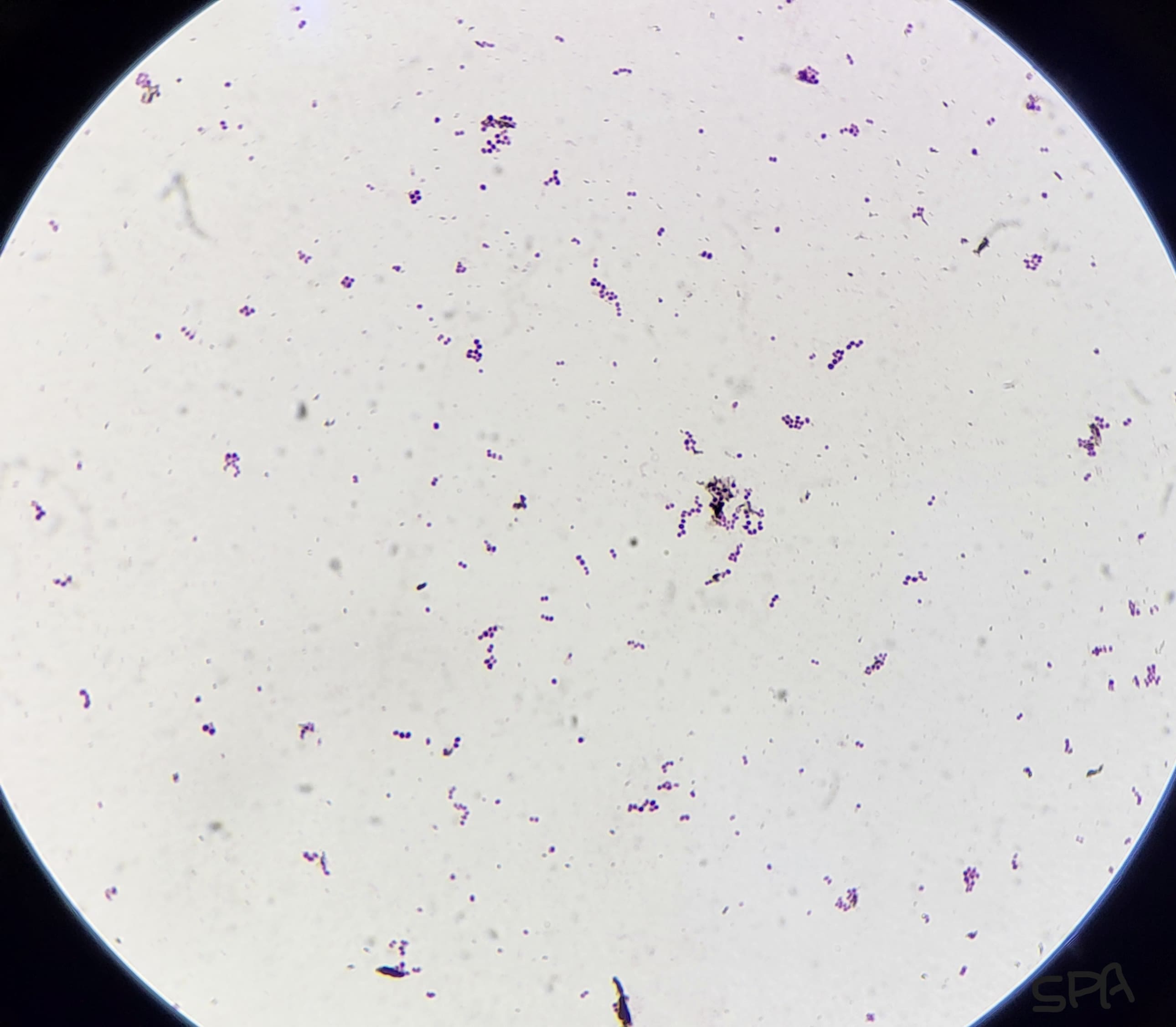 16. Streptococci  Microscopic